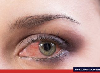 Cuidado con el ojo rojo